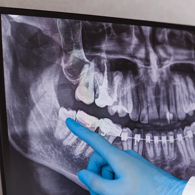 Image of a dentist pointing at an xray scan