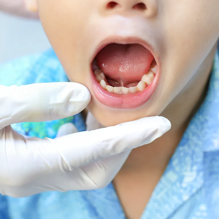 Image of a dentist opening a boys mouth