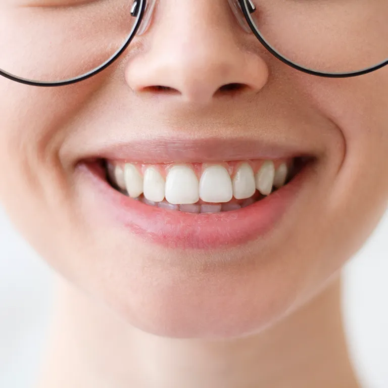 Close up image of a womans teeth