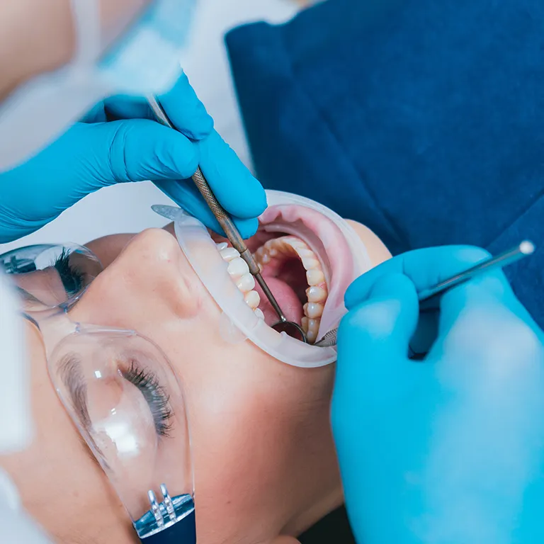 Image of a dentist working in a patients mouth