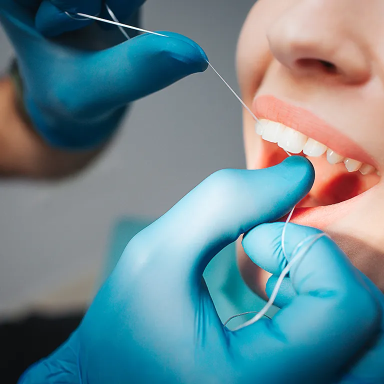 Image of a womans teeth being flossed