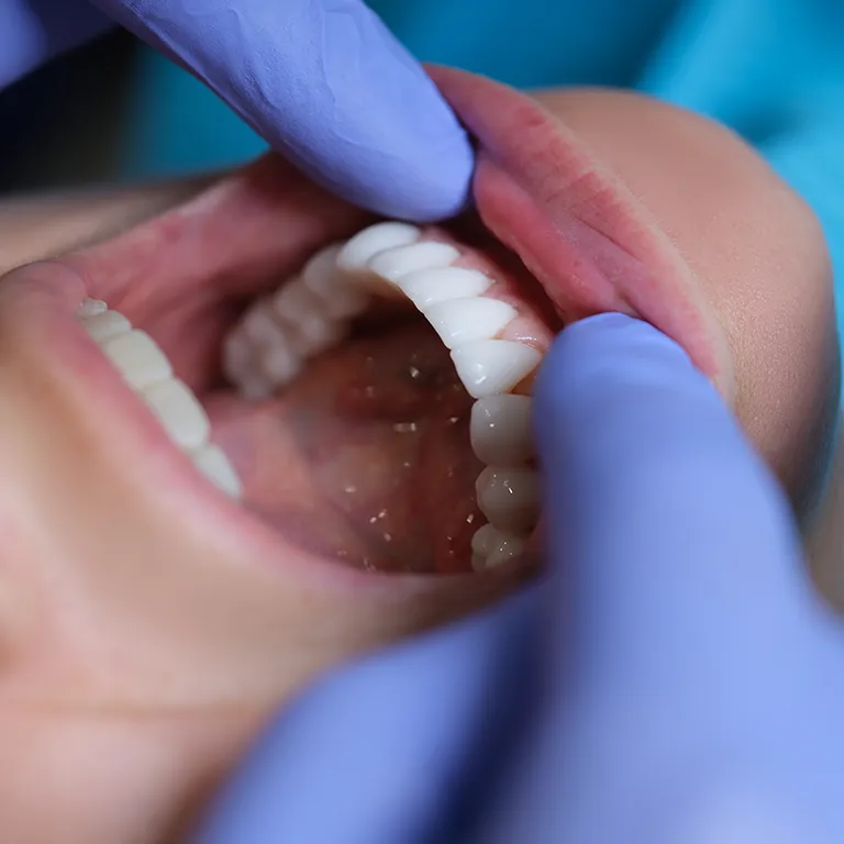 Image of a dentist examining a mans mouth