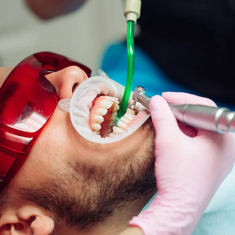 Image of a dentist polishing a mans mouth