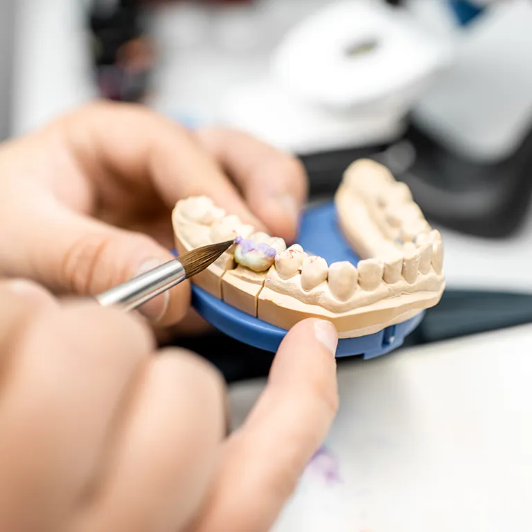 Image of a dentist painting teeth bridge